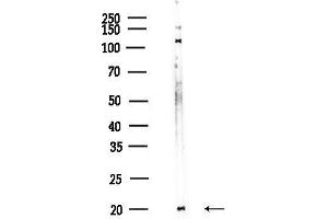 Western blot analysis of lysates from HUVEC cells, using NDUF Antibody at 1/1000 dilution.