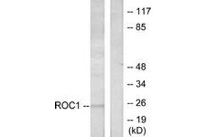 Western blot analysis of extracts from Jurkat cells, using RIT1 Antibody. (RIT1 Antikörper  (AA 170-219))