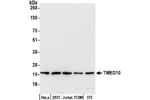 Western Blotting (WB) image for anti-Transmembrane Emp24-Like Trafficking Protein 10 (TMED10) (AA 50-100) antibody (ABIN7453221)