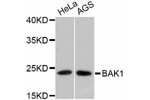 Western blot analysis of extracts of various cell lines, using BAK1 antibody (ABIN4903006). (BAK1 Antikörper)