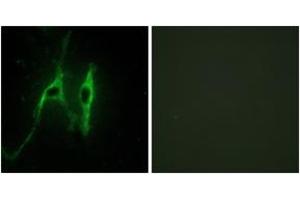 Immunofluorescence (IF) image for anti-Cytochrome B5 Type A (Microsomal) (CYB5A) (AA 61-110) antibody (ABIN2889983) (CYB5A Antikörper  (AA 61-110))