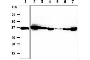 The cell lysates (40ug) were resolved by SDS-PAGE, transferred to PVDF membrane and probed with anti-human CPOX antibody (1:500).