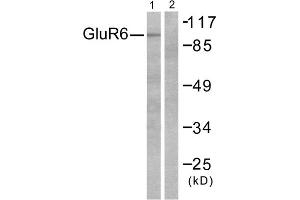Western blot analysis of extracts from mouse brain, using GluR6 antibody (ABIN5976413). (Metabotropic Glutamate Receptor 6 Antikörper  (C-Term))