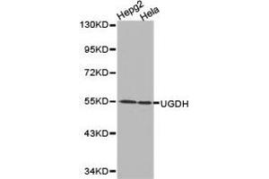 Western Blotting (WB) image for anti-UDP-Glucose 6-Dehydrogenase (UGDH) antibody (ABIN1875273) (UGDH Antikörper)