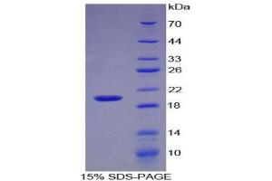 SDS-PAGE (SDS) image for Interleukin 17 (IL17) (AA 20-155) protein (His tag) (ABIN1879842)
