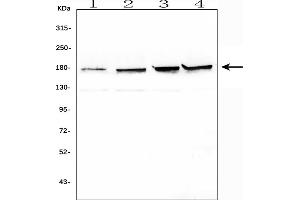 Western blot analysis of TOP2A using anti-TOP2A antibody (ABIN7602988).