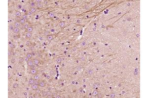 Immunohistochemistry (Paraffin-embedded Sections) (IHC (p)) image for anti-Nuclear Factor of Activated T-Cells, Cytoplasmic, Calcineurin-Dependent 1 (NFATC1) (AA 601-716) antibody (ABIN686257)