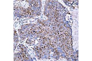 IHC analysis of p57 Kip2/CDKN1C using anti-p57 Kip2/CDKN1C antibody (ABIN7603232).