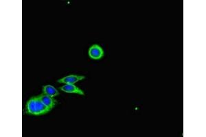 Immunofluorescent analysis of HepG2 cells using ABIN7148044 at dilution of 1:100 and Alexa Fluor 488-congugated AffiniPure Goat Anti-Rabbit IgG(H+L) (Cofilin Antikörper  (AA 4-144))