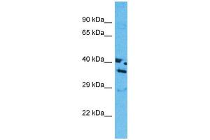 Western Blotting (WB) image for anti-Olfactory Receptor, Family 13, Subfamily J, Member 1 (OR13J1) (C-Term) antibody (ABIN2791823) (OR13J1 Antikörper  (C-Term))