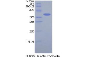 SDS-PAGE analysis of Mouse Cystatin A Protein.