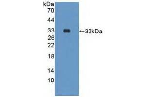 Western blot analysis of recombinant Human PIK3Cd. (PIK3CD Antikörper  (AA 774-1044))