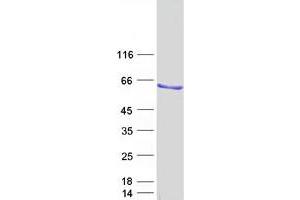 Western Blotting (WB) image for ELK4, ETS-Domain Protein (SRF Accessory Protein 1) (ELK4) (Transcript Variant B) protein (Myc-DYKDDDDK Tag) (ABIN2720140)