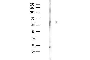 Western blot analysis of lysates from PC12 cells(LPS 4h treatment), using A-RAF Antibody at 1/1000 dilution.