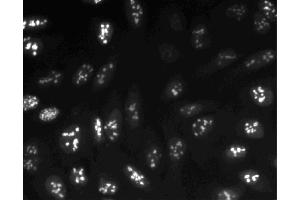 Immunofluorescent staining of U-2 OS (ATCC HTB-96) cells. (Ki-67 Antikörper  (AA 1547-1742))