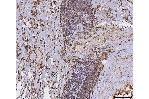 IHC analysis of HLA-DRA using anti-HLA-DRA antibody (ABIN7600950). (HLA-DRA Antikörper  (AA 26-254))