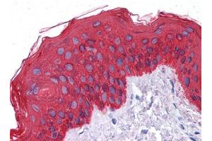 Immunohistochemical analysis of paraffin-embedded human Skin tissues using CK mouse mAb (Cytokeratin 1 Antikörper)