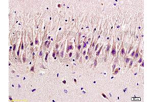 Formalin-fixed and paraffin embedded rat brain labeled with Rabbit Anti 5-HTR2A/HTR2A Polyclonal Antibody, Unconjugated (ABIN737016) at 1:200 followed by conjugation to the secondary antibody and DAB staining (HTR2A Antikörper  (AA 65-160))