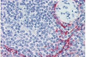 Human Spleen (formalin-fixed, paraffin-embedded) stained with MADCAM1 antibody ABIN462006 at 10 ug/ml followed by biotinylated anti-mouse IgG secondary antibody ABIN481714, alkaline phosphatase-streptavidin and chromogen. (MADCAM1 Antikörper)