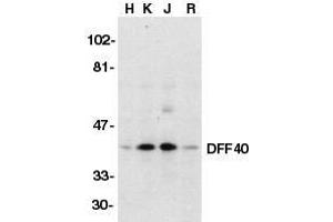 Western blot analysis of DFF40/CAD in HeLa (H), K562 (K), Jurkat (J), and Raji (R) whole cell lysate with DFF40/CAD antibody at 1μg/ml. (DFFB Antikörper  (AA 147-164))