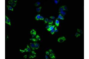 Immunofluorescence staining of PC-3 cells with ABIN7166148 at 1:266, counter-stained with DAPI. (SPRY1 Antikörper  (AA 1-178))