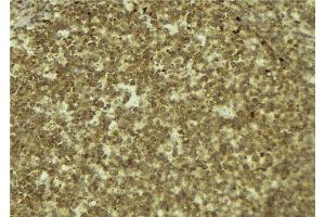 ABIN6272552 at 1/100 staining Mouse pancreas tissue by IHC-P. (MYCBP Antikörper  (N-Term))