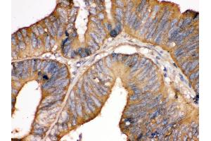Immunohistochemistry (Paraffin-embedded Sections) (IHC (p)) image for anti-TF (AA 20-49), (N-Term) antibody (ABIN3043419) (TF (AA 20-49), (N-Term) Antikörper)