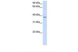 Image no. 1 for anti-Chromosome 21 Open Reading Frame 91 (C21orf91) (AA 182-231) antibody (ABIN6738191) (C21orf91 Antikörper  (AA 182-231))