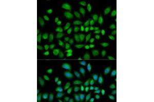 Immunofluorescence analysis of HeLa cells using PDE4D Polyclonal Antibody (PDE4D Antikörper)