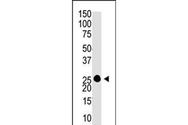 GCAP1 Antikörper  (C-Term)