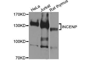 Western blot analysis of extracts of various cell lines, using INCENP antibody (ABIN5996452) at 1/1000 dilution. (INCENP Antikörper)