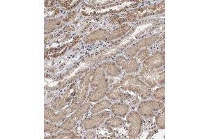 Immunohistochemical analysis of (ABIN391585 and ABIN2841517) on paraffin-embedded Human kidney tissue. (TECPR1 Antikörper  (C-Term))