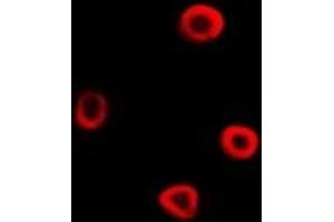 Immunofluorescent analysis of IRSp53 staining in A549 cells. (BAIAP2 Antikörper)