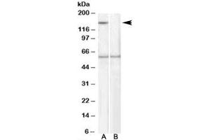 Western blot testing of human EBV-immortilized lymphoblastoid lysate with SIPA1 antibody at 1ug/ml, with (B) and without (A) immunizing peptide. (SIPA1 Antikörper)