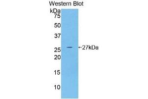 Detection of Recombinant GSTm4, Human using Polyclonal Antibody to Glutathione S Transferase Mu 4 (GSTm4) (GSTM4 Antikörper  (AA 18-215))