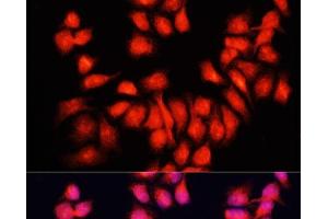Immunofluorescence analysis of HeLa cells using BMP6 Polyclonal Antibody at dilution of 1:100. (BMP6 Antikörper)