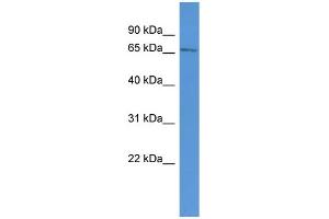 Western Blotting (WB) image for anti-Amyloid beta (A4) Precursor Protein-Binding, Family B, Member 1 Interacting Protein (APBB1IP) (N-Term) antibody (ABIN2787169)