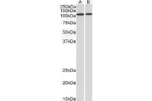 Western Blotting (WB) image for anti-Bone Morphogenetic Protein 1 (BMP1) (AA 284-296) antibody (ABIN2613394)