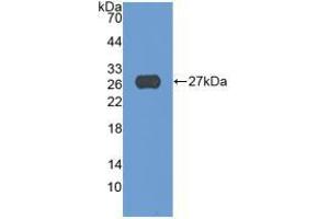 Western blot analysis of recombinant Human ADAM17.