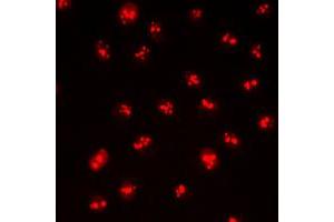 Immunofluorescent analysis of CDYL2 staining in HepG2 cells. (CDYL2 Antikörper  (N-Term))