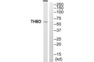 Western Blotting (WB) image for anti-Thrombomodulin (THBD) (C-Term) antibody (ABIN1852276) (Thrombomodulin Antikörper  (C-Term))