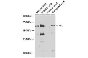 Western blot analysis of extracts of various cell lines, using PPL antibody (ABIN6128532, ABIN6146036, ABIN6146038 and ABIN6222699) at 1:1000 dilution. (PPL Antikörper  (AA 1-130))