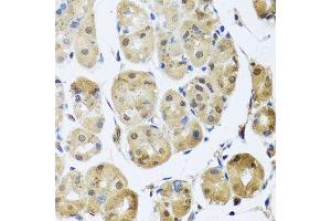 Immunohistochemistry (Paraffin-embedded Sections) (IHC (p)) image for anti-TAF15 RNA Polymerase II, TATA Box Binding Protein (TBP)-Associated Factor, 68kDa (TAF15) (AA 1-280) antibody (ABIN6148818)