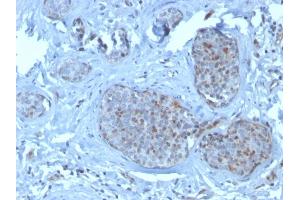 Immunohistochemistry (IHC) image for anti-Mdm2, p53 E3 Ubiquitin Protein Ligase Homolog (Mouse) (MDM2) (AA 154-167) antibody (ABIN6940030)