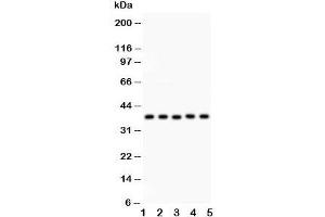 Western blot testing of KLF6 antibody and Lane 1:  human placenta;  2: rat testis;  3: (h) HeLa;  4: (h) HEPG2;  5: mouse HEPA lysate.