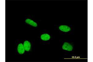 Immunofluorescence of monoclonal antibody to HOXA11 on HeLa cell. (Homeobox A11 Antikörper  (AA 60-166))