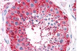 Human Testis: Formalin-Fixed, Paraffin-Embedded (FFPE) (ADAM20 Antikörper  (Internal Region))