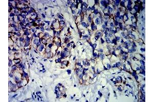 Immunohistochemistry (IHC) image for anti-Keratin 13 (KRT13) (AA 104-458) antibody (ABIN7193705)
