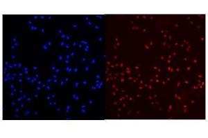 anti-Mediator Complex Subunit 15 (MED15) (AA 1-285) antibody
