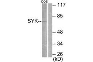 Western Blotting (WB) image for anti-Spleen tyrosine Kinase (SYK) (AA 491-540) antibody (ABIN2888611) (SYK Antikörper  (AA 491-540))